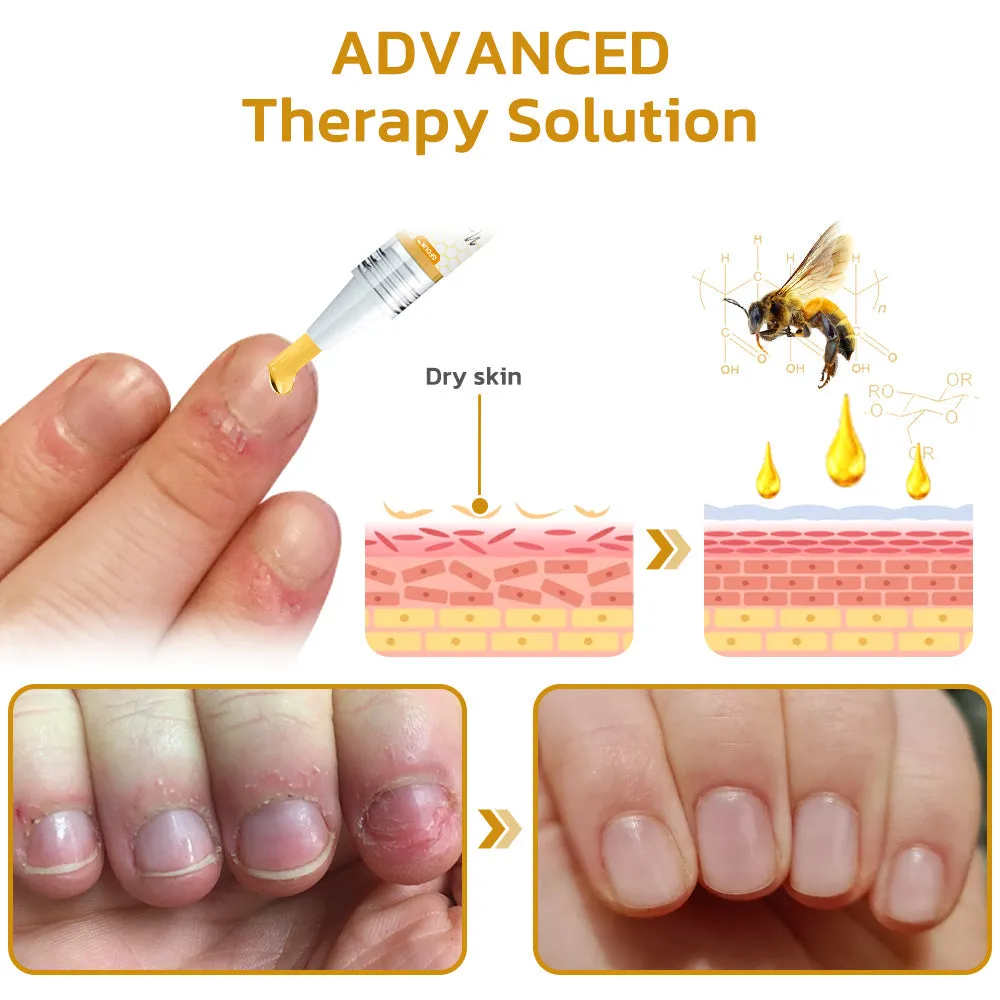 GFOUK™ NailPlus Strong Bee Venom 7 Days Growth Nail Gel