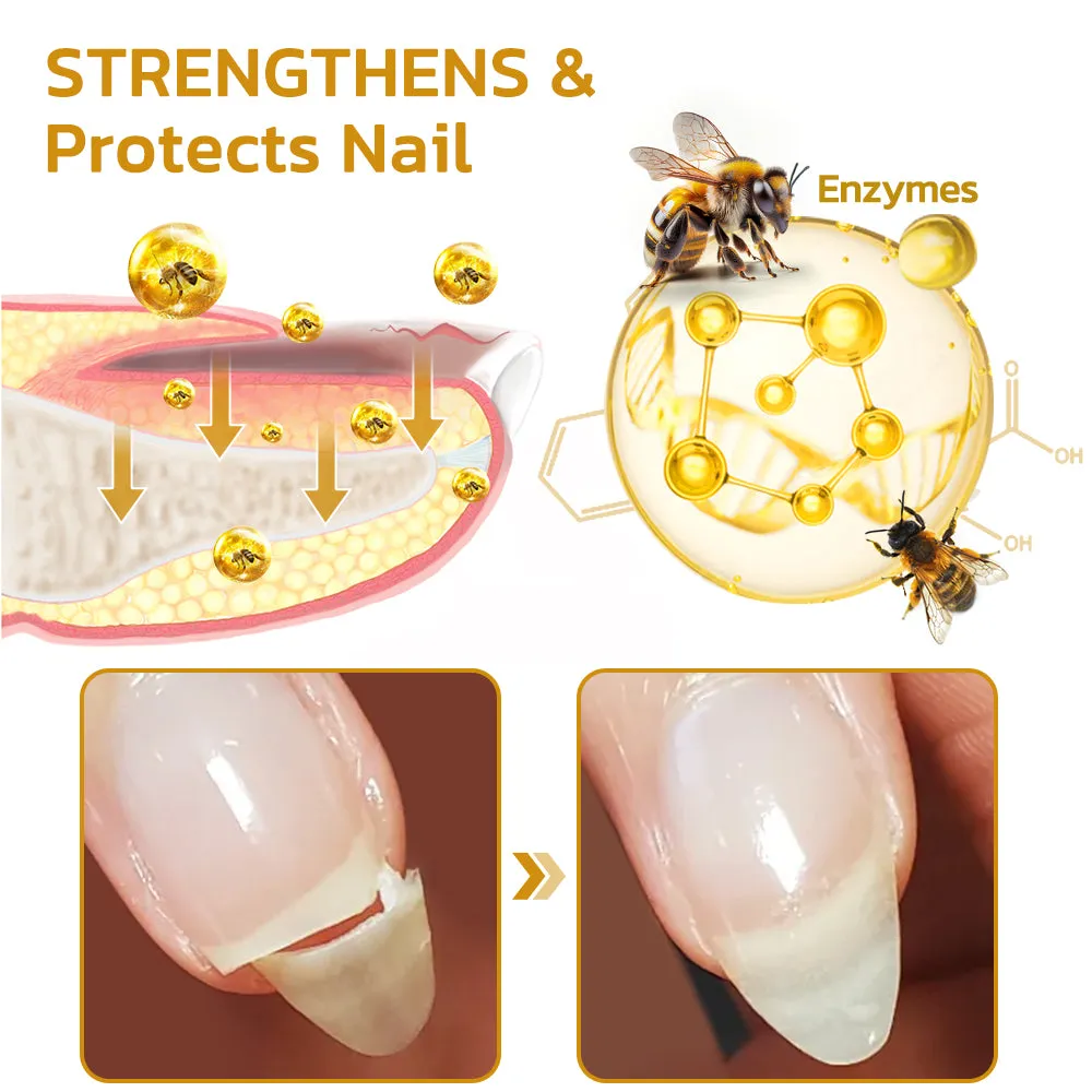 GFOUK™ NailPlus Strong Bee Venom 7 Days Growth Nail Gel