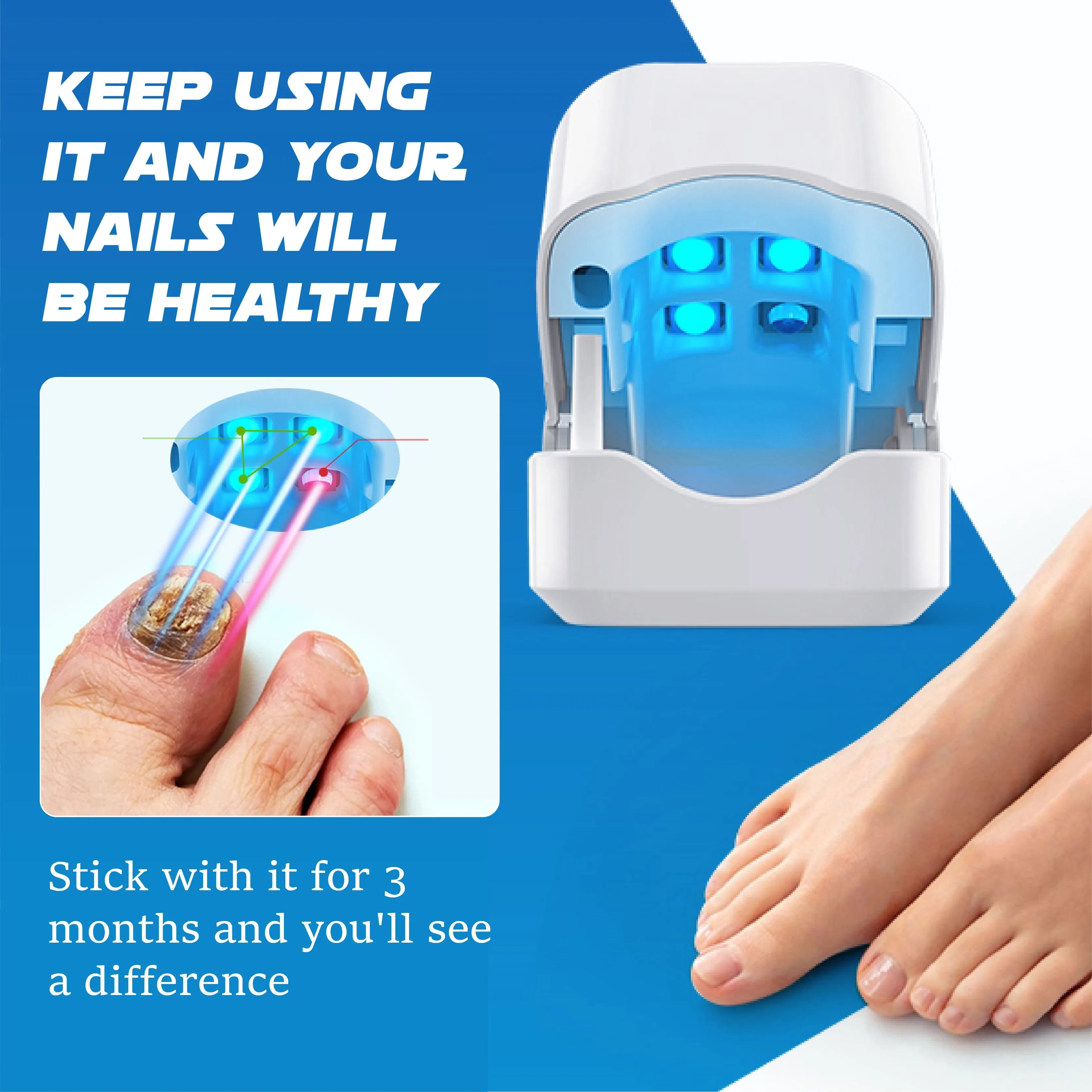RICPIND LightTherapy NailRenew ProDevice